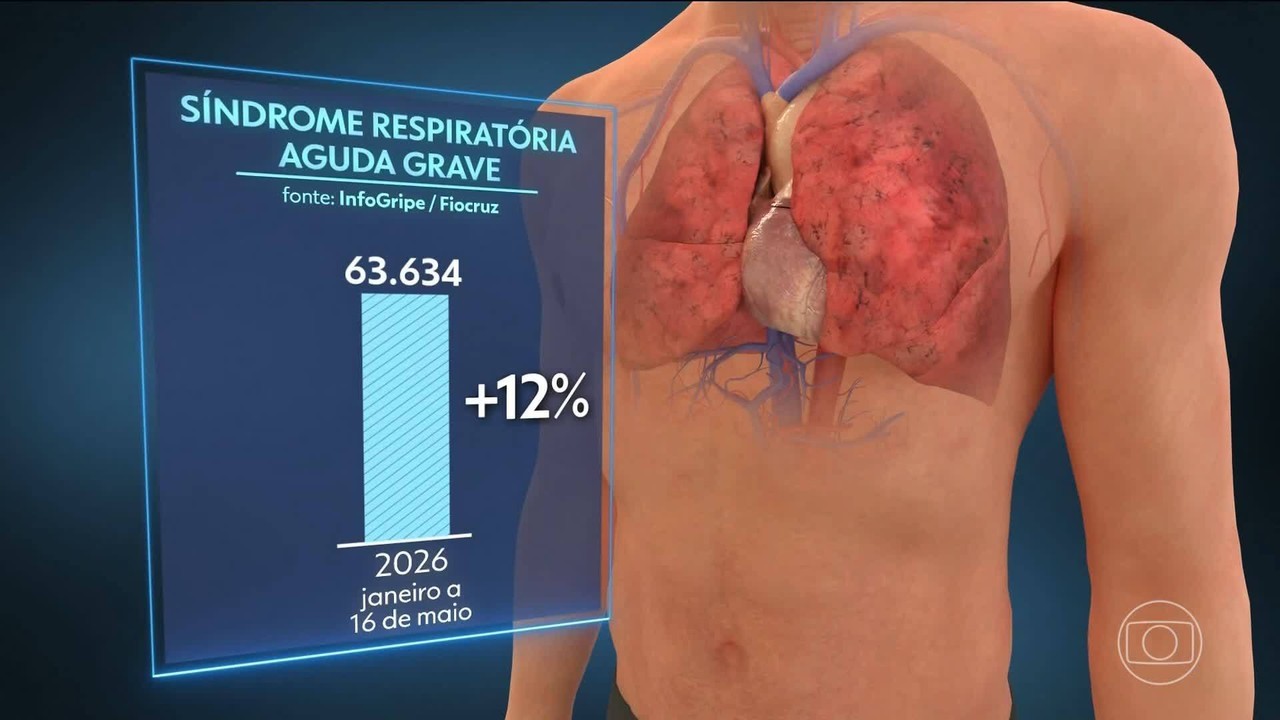 Casos graves de gripe pressionam hospitais e acendem alerta em quase todo o Brasil