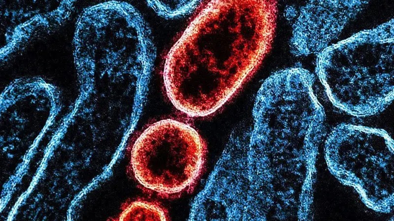 Nipah: o vírus que causa preocupação na Ásia e voltou a deixar aeroportos em alerta na região