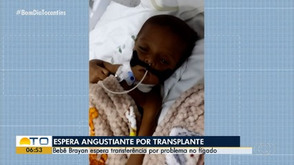 Conheça a história do bebê Brayan que espera por transferência para transplante no fígado