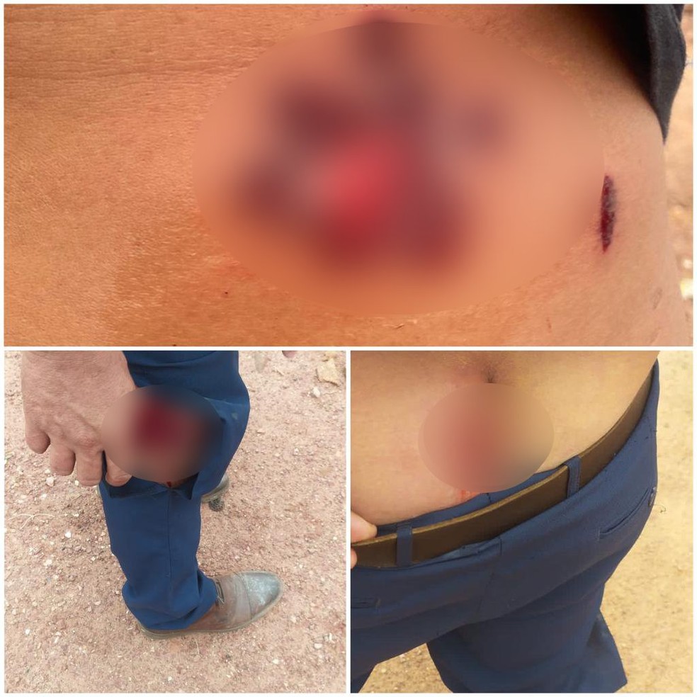 Moradores se feriram com tiros de borracha durante o confronto — Foto: Reprodução