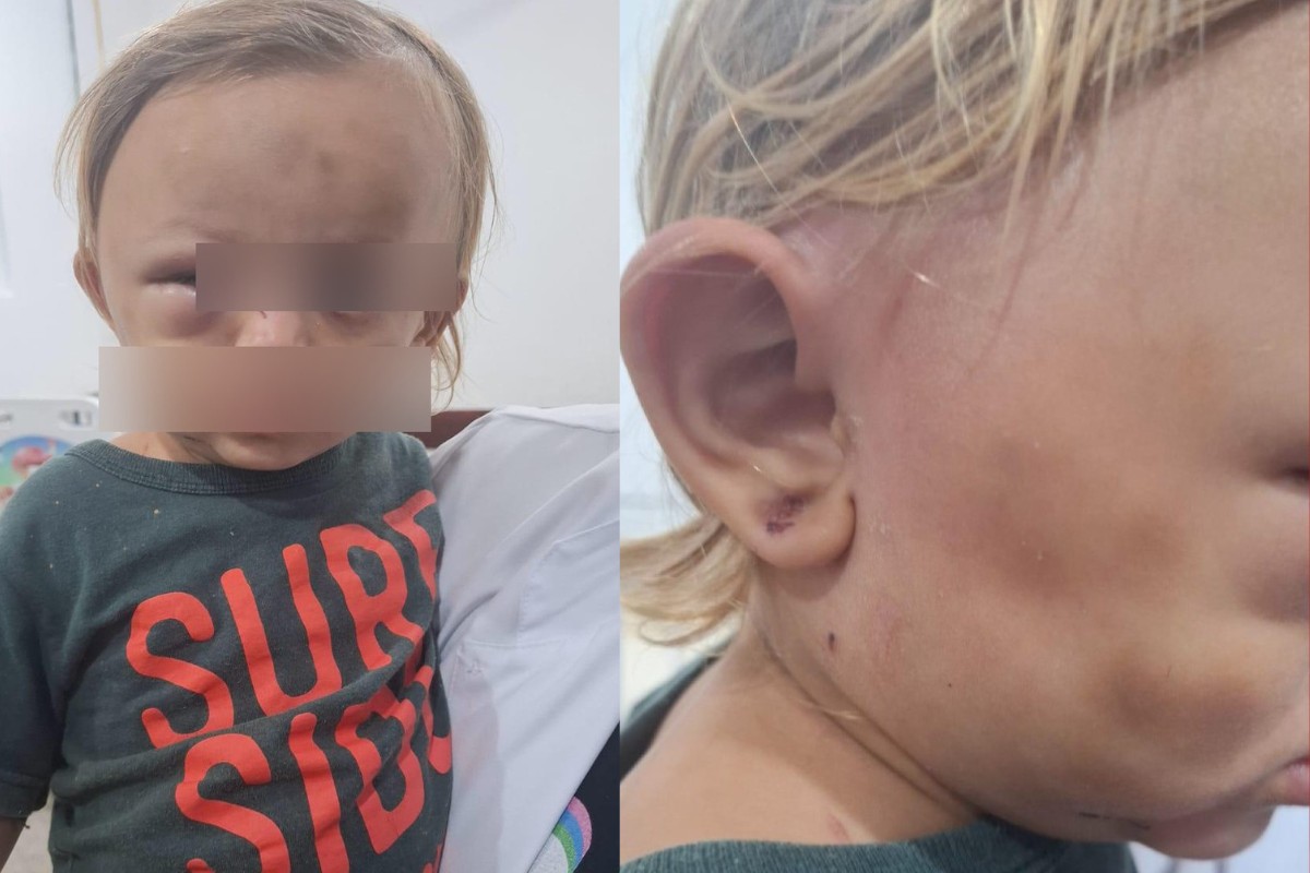 Padrasto e mãe sob efeito de drogas espancam criança em Cuiabá