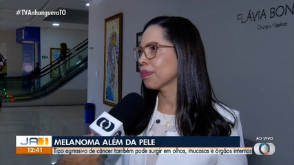 Melanoma vai além da pele; médica explica os sinais