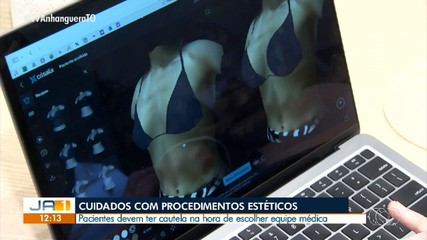 Especialista explica os cuidados a serem tomados antes dos procedimentos estéticos