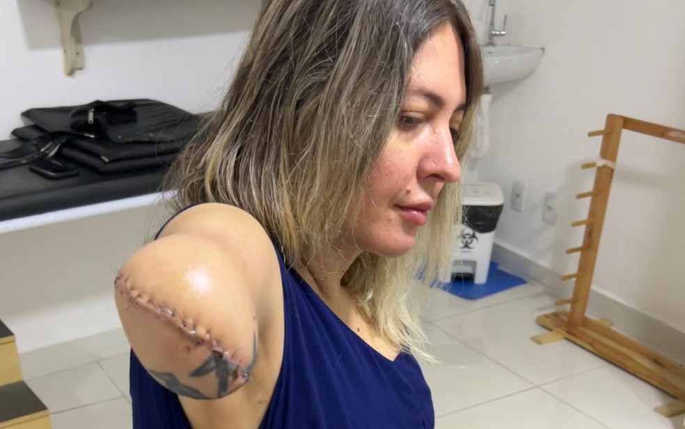 Tatuadora Camila Gama Braga de Oliveira teve o braço amputado por complicações após cirurgia em Goiânia — Foto: Arquivo Pessoal/Camila Gama