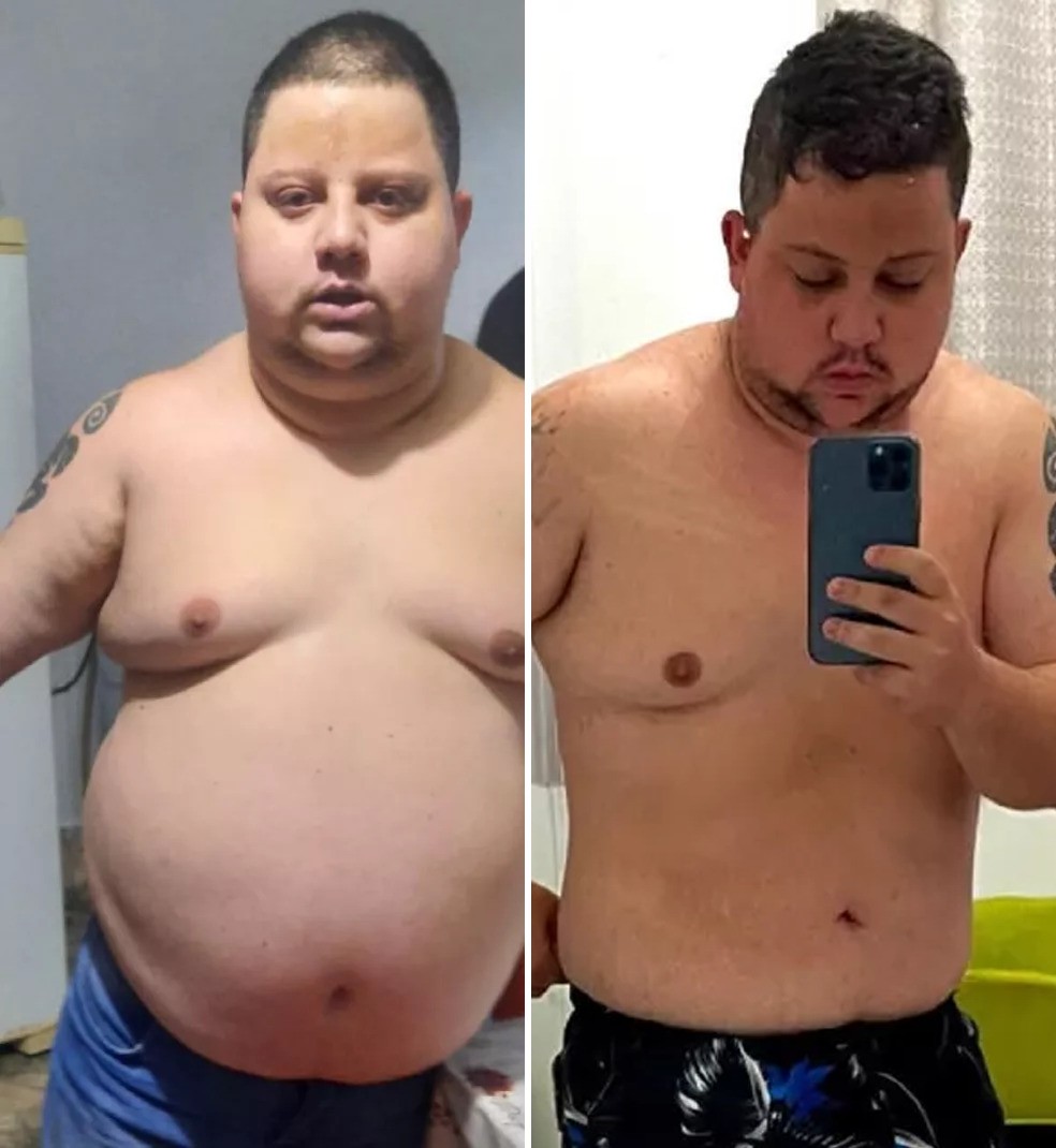 Jovem luta contra a obesidade e emagrece 38 quilos em sete meses