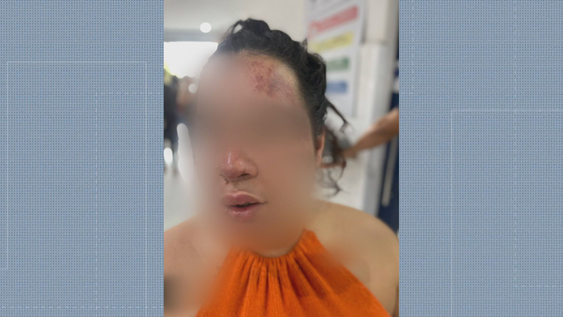 Mulher denuncia que foi espancada e roubada pelo ex-companheiro em São Gonçalo: 'ele me enforcou, ele quase me matou'