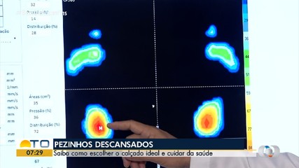 Saiba que cuidados tomar na hora de escolher calçados