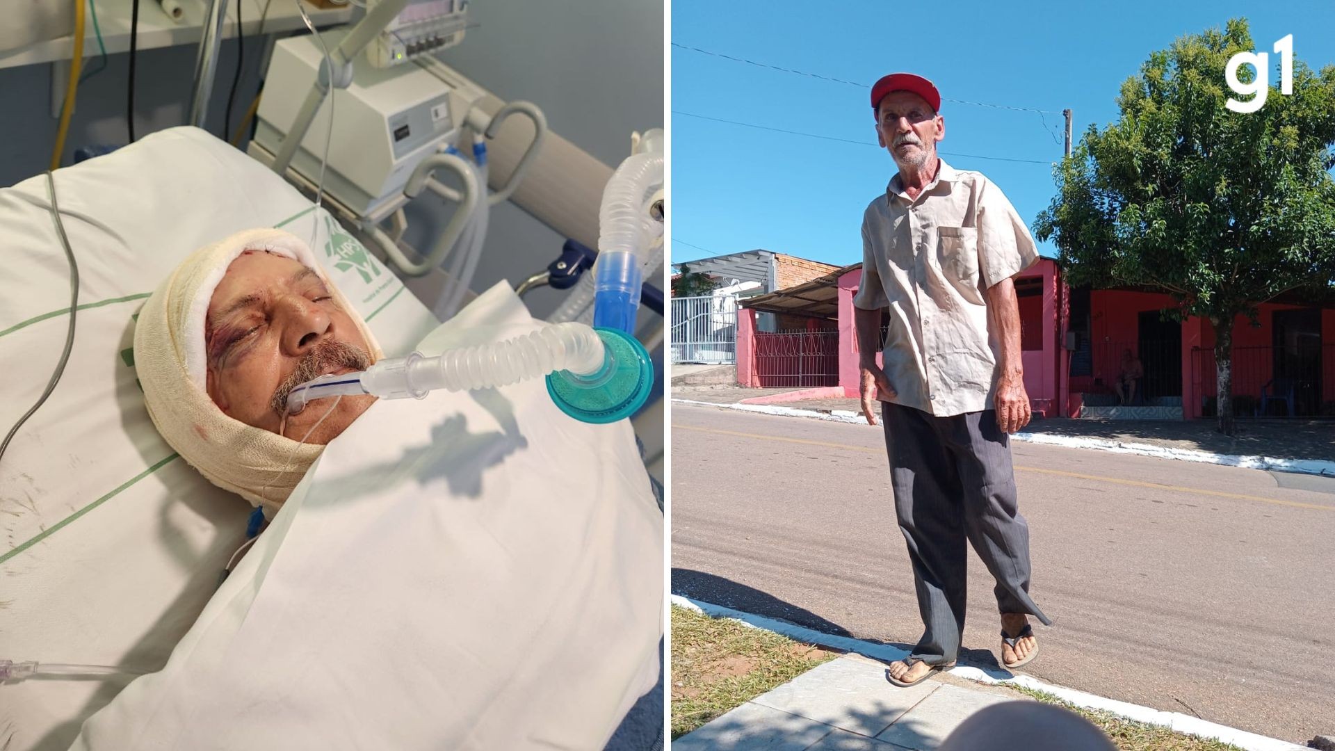 Entregador entra em coma após ser atacado por cinco pittbulls em Minas do Leão