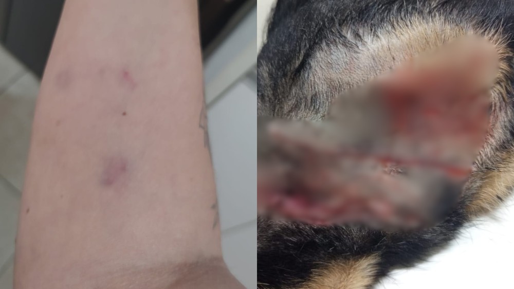Mulher luta com pit bull para salvar cadela de ataque em Patos de Minas