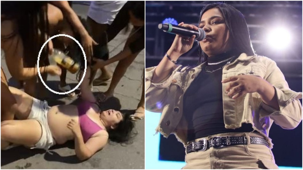 Cantora Greycielle Nunes ficou com a testa cortada após uma garrafa de vidro ser quebrada em sua cabeça durante briga com outra mulher no Crato. — Foto: Instagram/ Reprodução