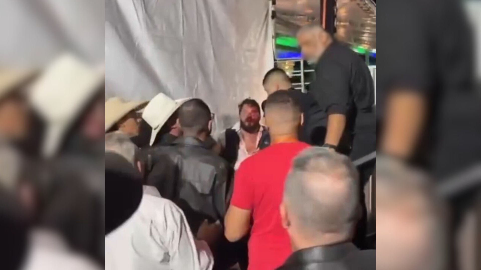 Cantor diz que foi agredido por produtor antes de show de Eduardo Costa: 'Me deixou com quatro pontos'