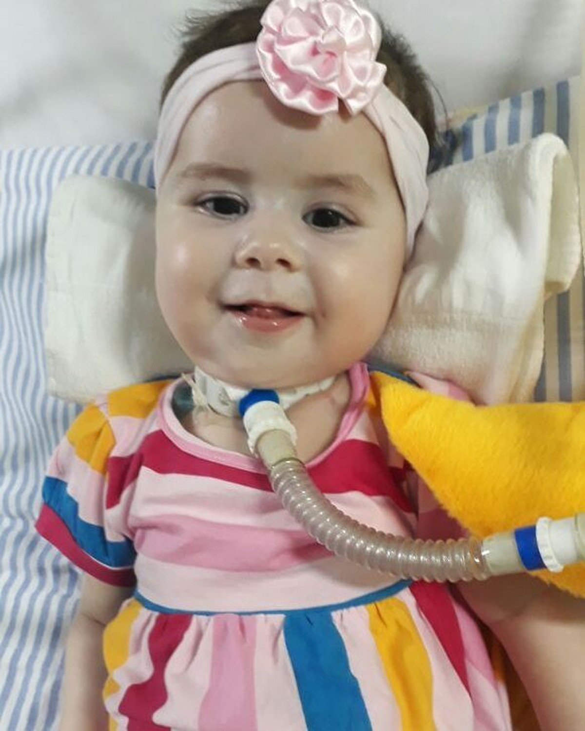 G1 - Doença rara em menina de 2 anos mobiliza campanha de família