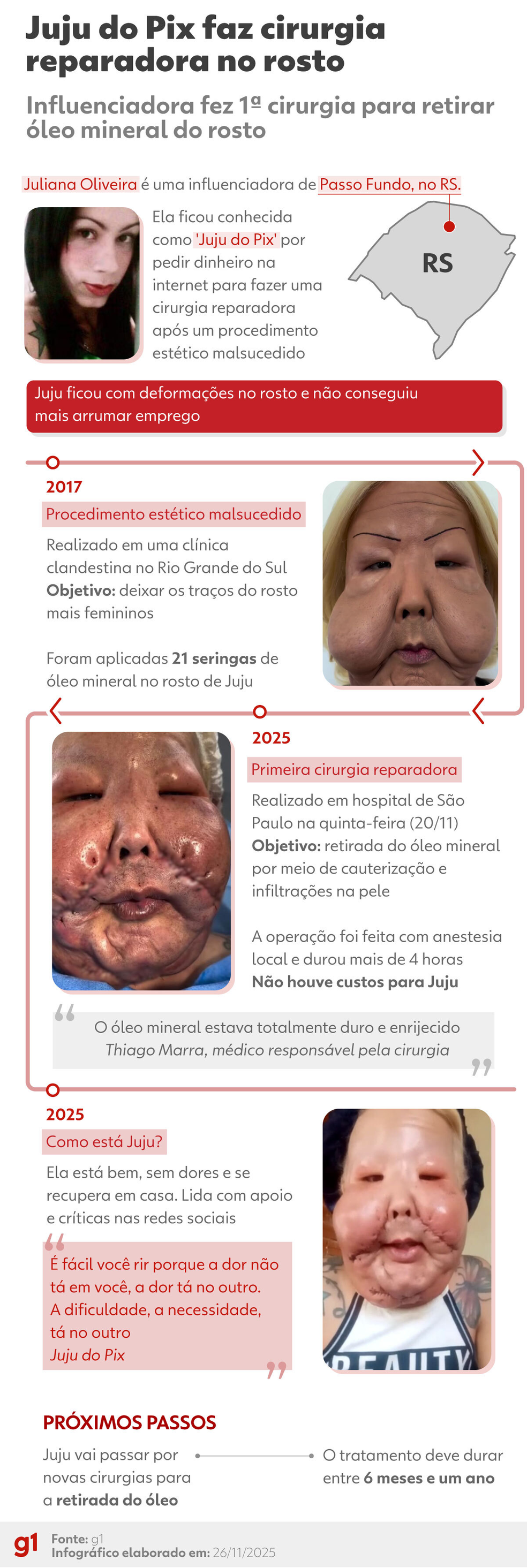 Infogr&aacute;fico - Juju do Pix faz cirurgia reparadora &mdash; Foto: Arte/g1