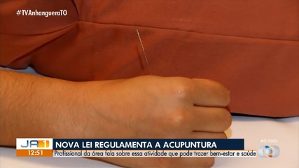 Governo federal publica nova lei relacionada à acupuntura