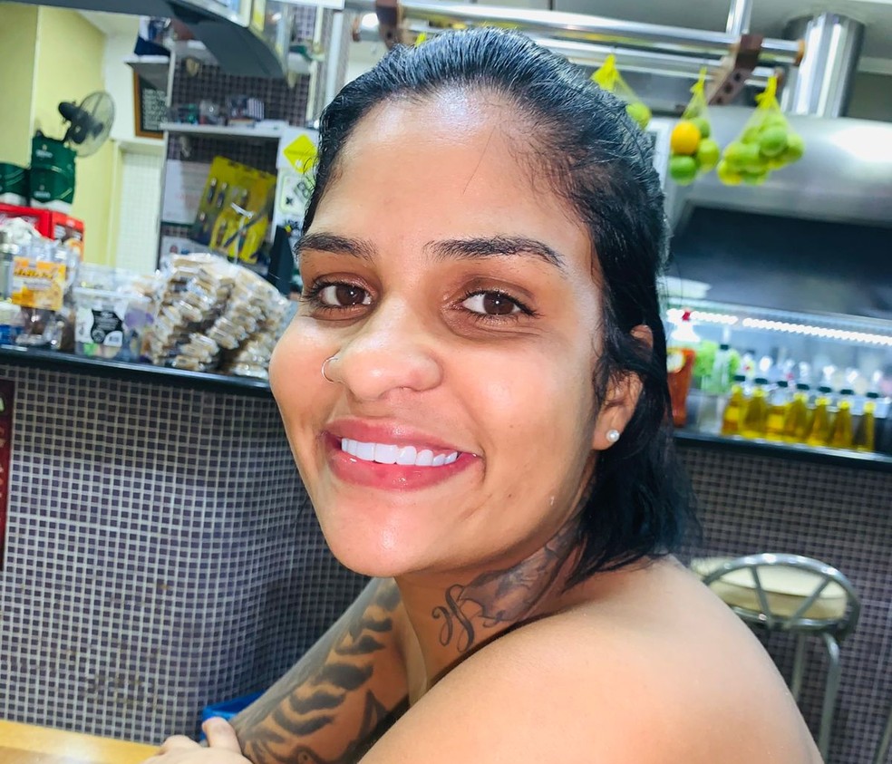 Mulher que teve pernas amputadas em SP irá passar por nova cirurgia | G1