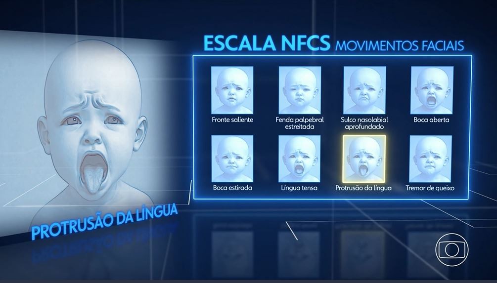 Médicos e engenheiros brasileiros criam IA que identifica dor em recém-nascidos