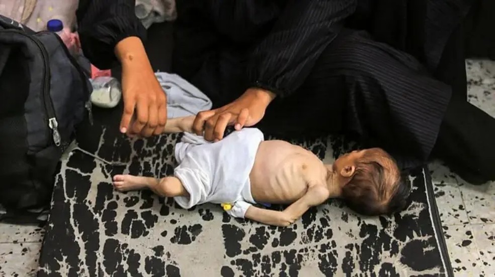 Falta de alimentos, desnutrição grave e mortalidade elevada: fome em Gaza atinge fase 5, o pior em escala de órgão ligado a ONU; entenda