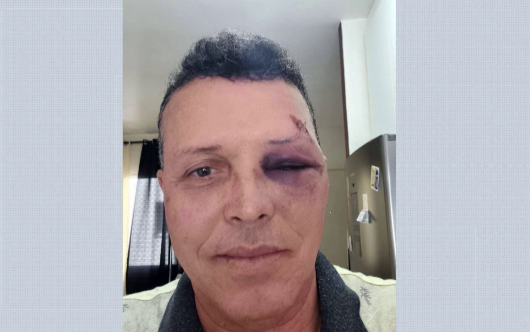 Motorista desabafa após ser agredido a pedrada por homem que pegava 'rabeira' em ônibus em Ribeirão Preto: 'Muito violentos'