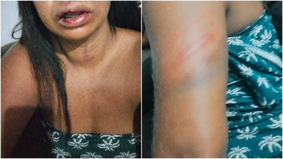 Mulher é agredida por atrasar ao pegar namorado no trabalho — Foto: Arquivo pessoal