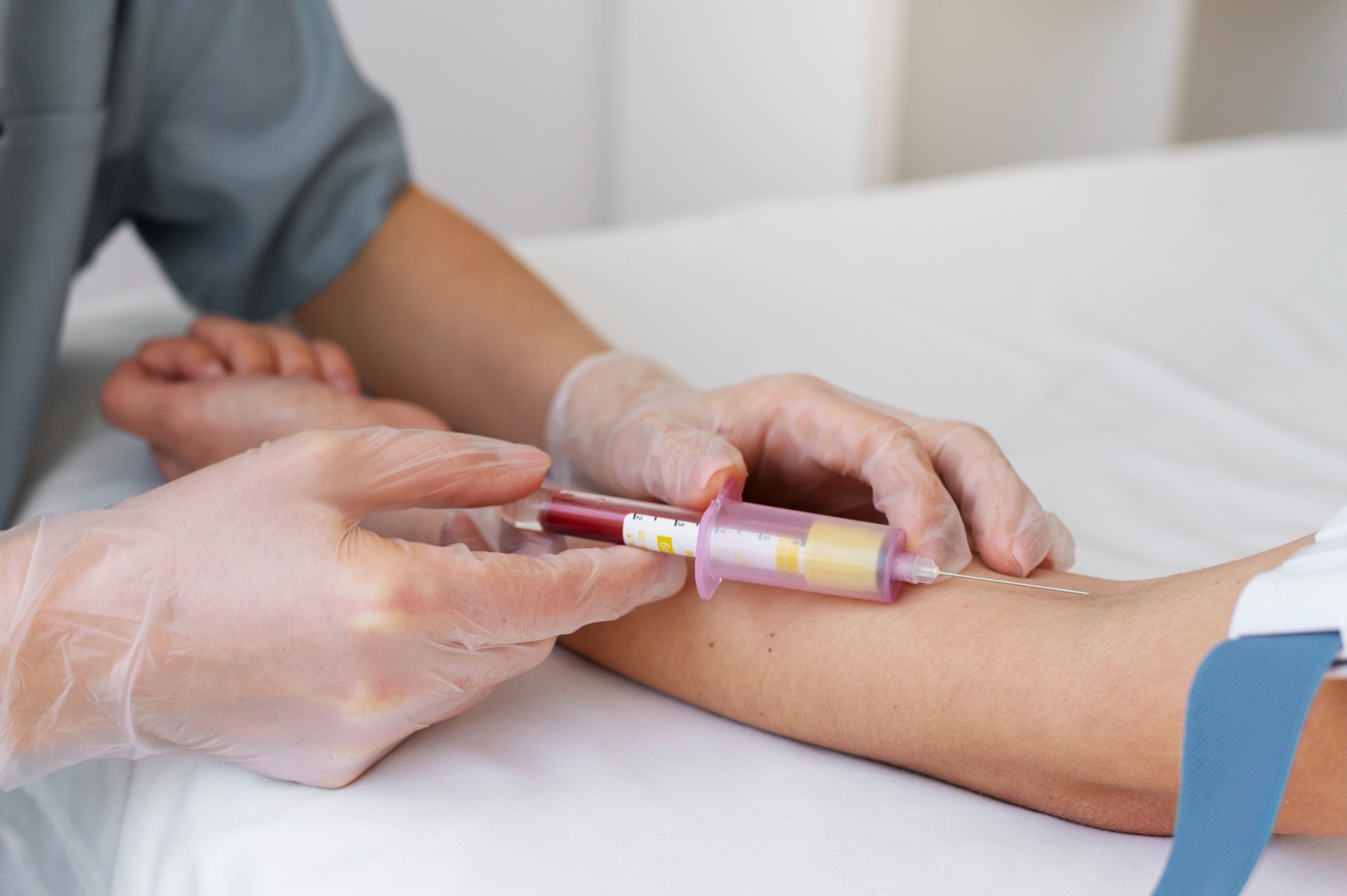 SUS Now Offers Rapid Dengue Test: Early Diagnosis Available