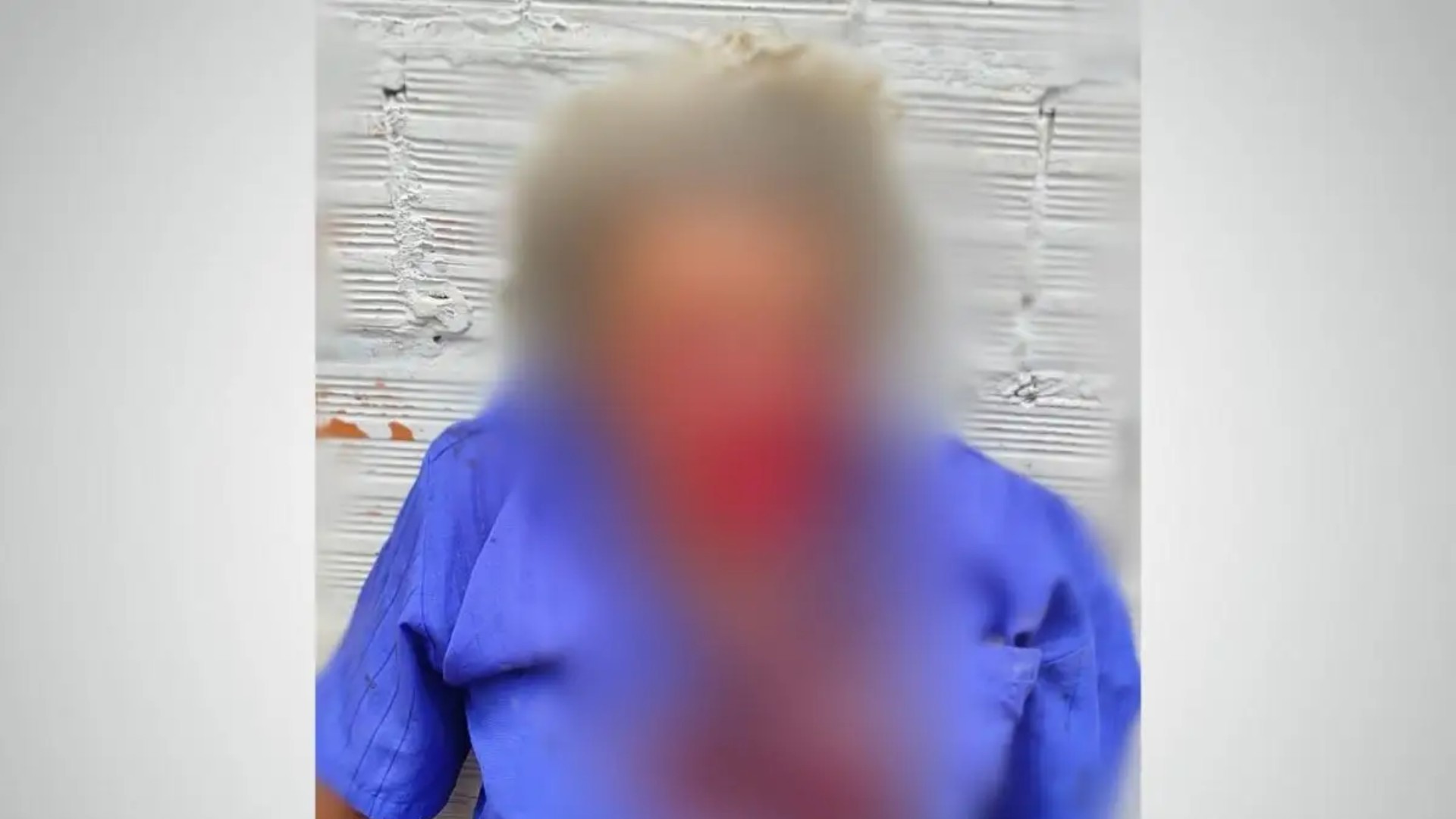 Pitbull ataca e causa mutilações graves no rosto de idoso em MS