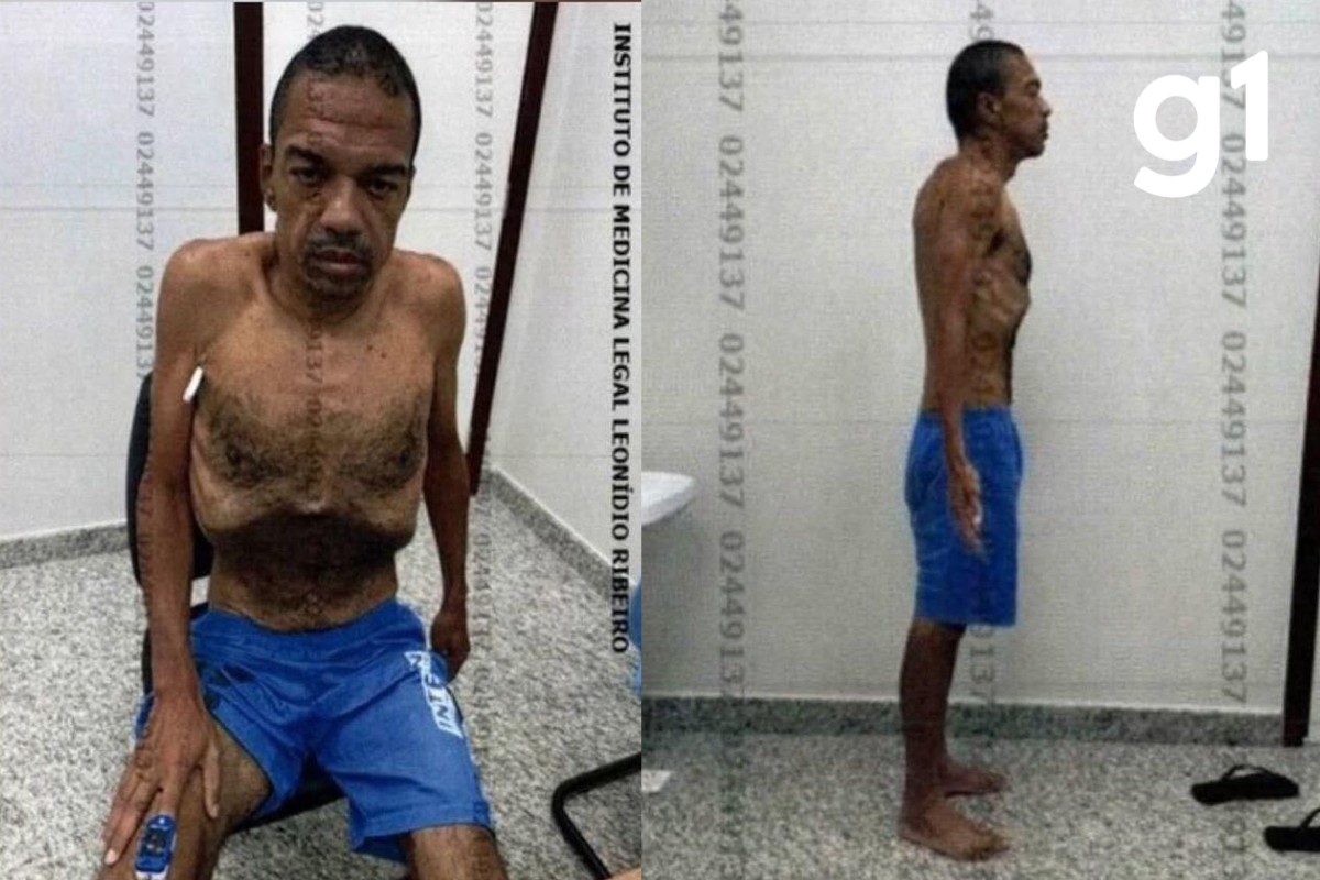 Quem é o lobista que ficou esquelético após 8 meses de prisão por esquema de vendas de decisões judiciais