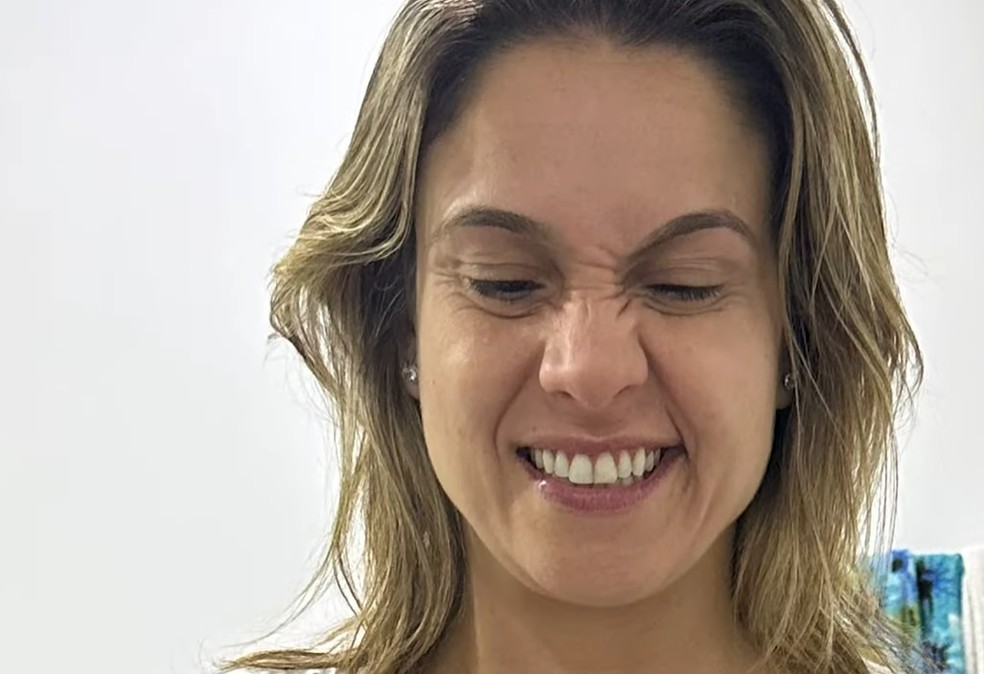 Fernanda Gentil fez exercícios no espelho e percebeu que um lado do rosto não correspondia — Foto: Repdodução