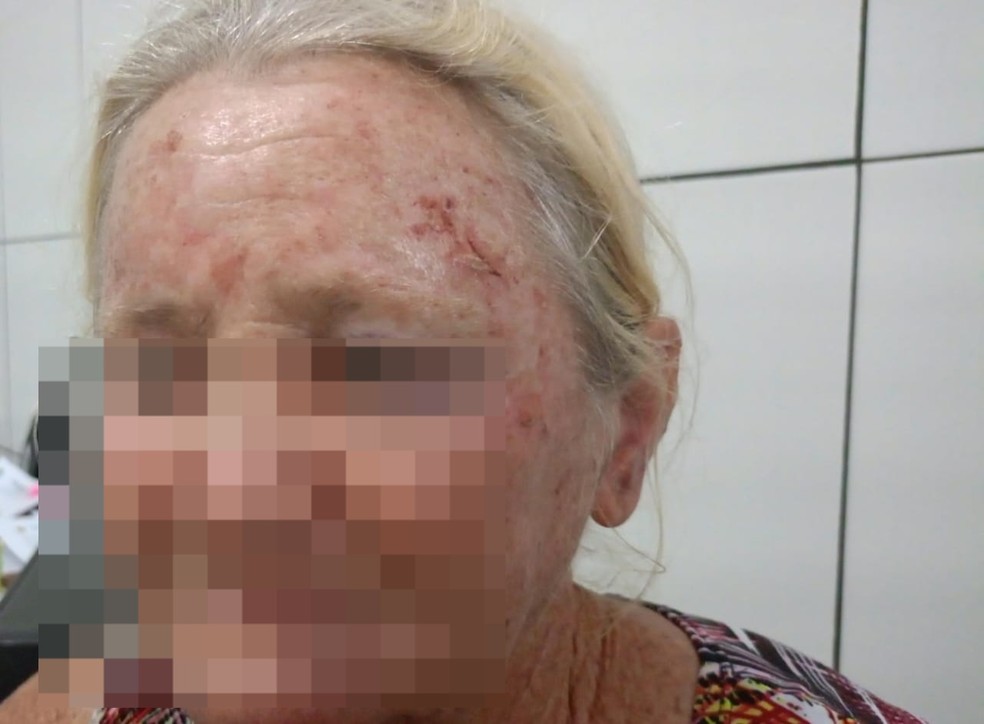 Idosa de 63 anos expulsa de casa dupla de assaltantes e esfaqueia adolescente — Foto: Polícia Civil