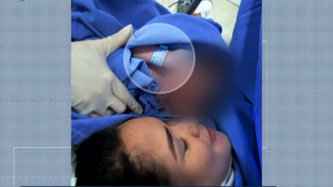 Foto mostra que um dos bebs trocados em maternidade tinha pulseira de identificao
