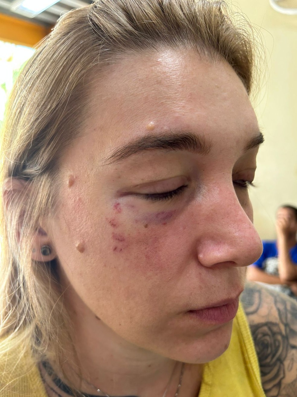 Mulher é agredida no 'Ensaios da Anitta' e diz que motivação foi homofóbica — Foto: Arquivo pessoal