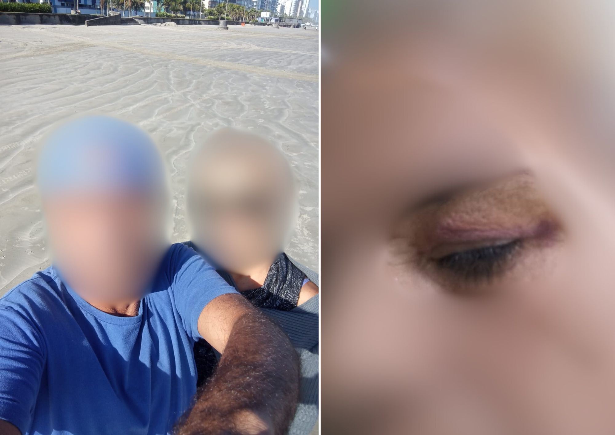 Mulher denuncia ex-namorado por agressão, perseguição e tentativa de estupro no litoral de SP