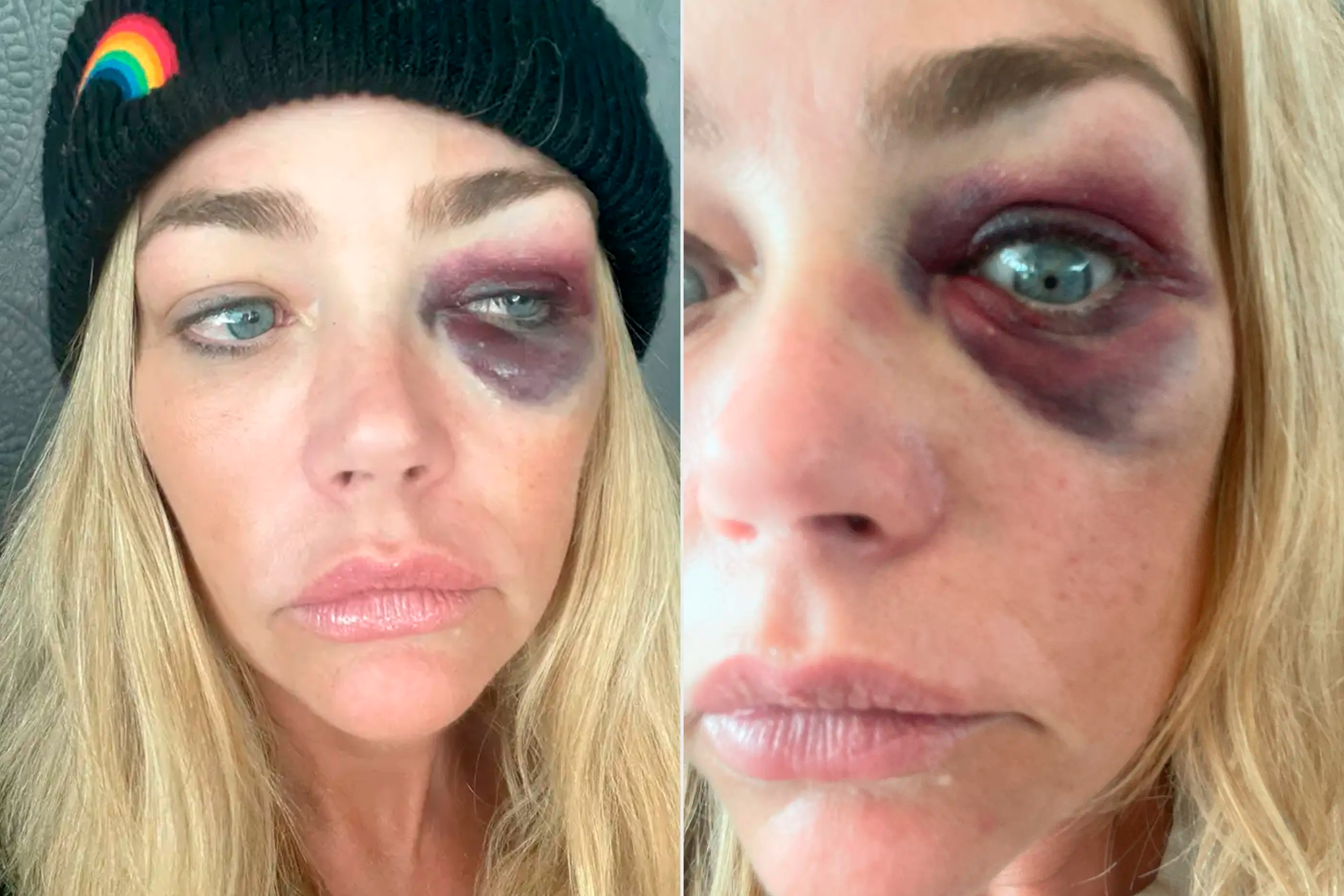 Denise Richards acusa ex-marido de agressão 