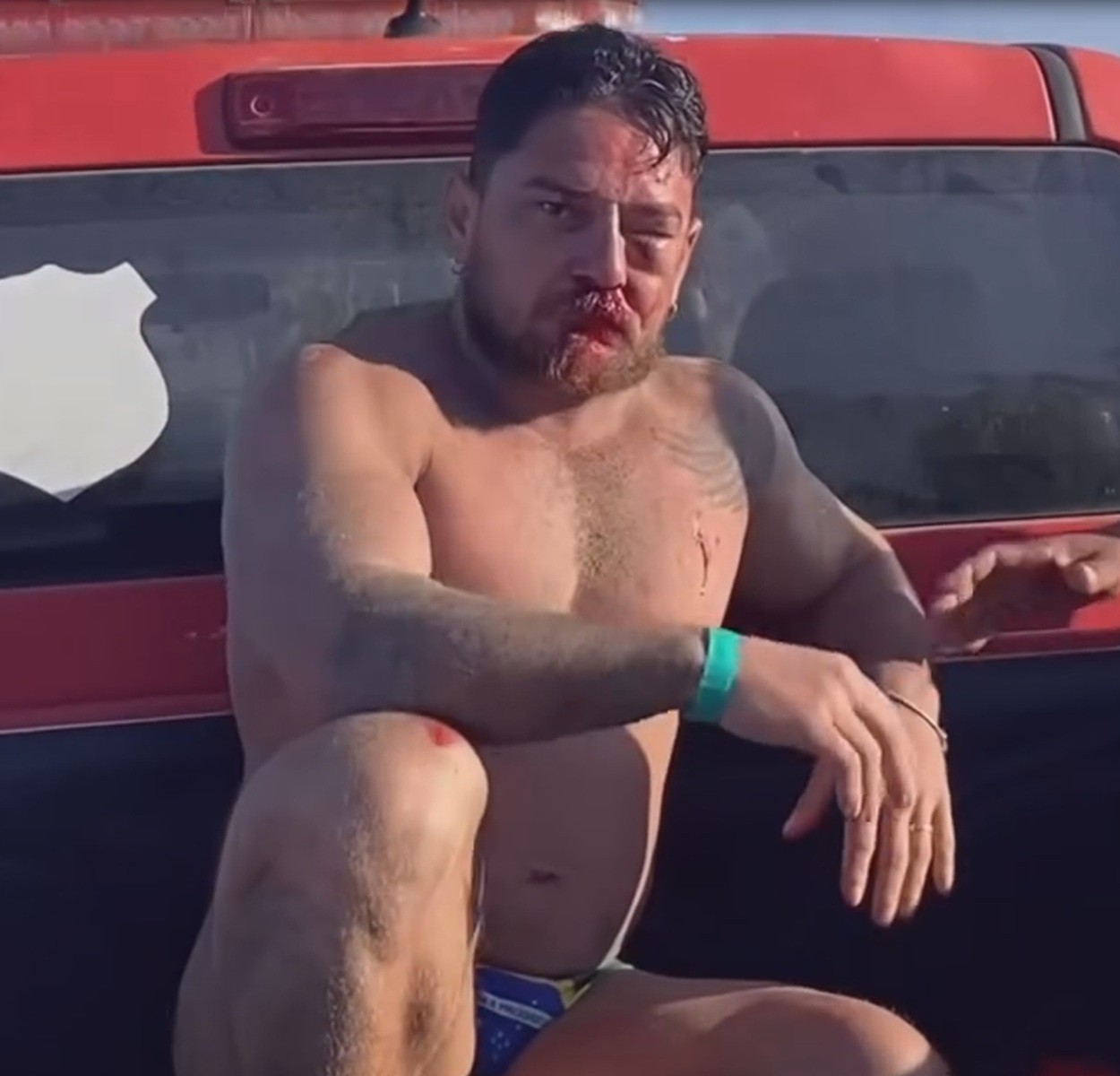 Casal de turistas de Mato Grosso são agredidos em Porto de Galinhas após cobrança abusiva por uso de cadeiras de praia: 'Eu vi a morte na nossa frente'