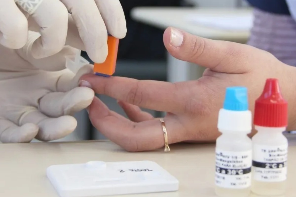 Profilaxia injetável revolucionária contra o HIV terá um longo e difícil caminho para chegar ao Brasil