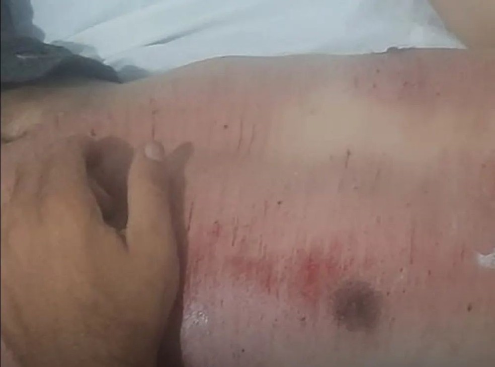 Homem atropelado por Hilux enquanto estava ca�do no asfalto no Cear� sofreu escoria��es na regi�o do t�rax &mdash; Foto: Reprodu��o