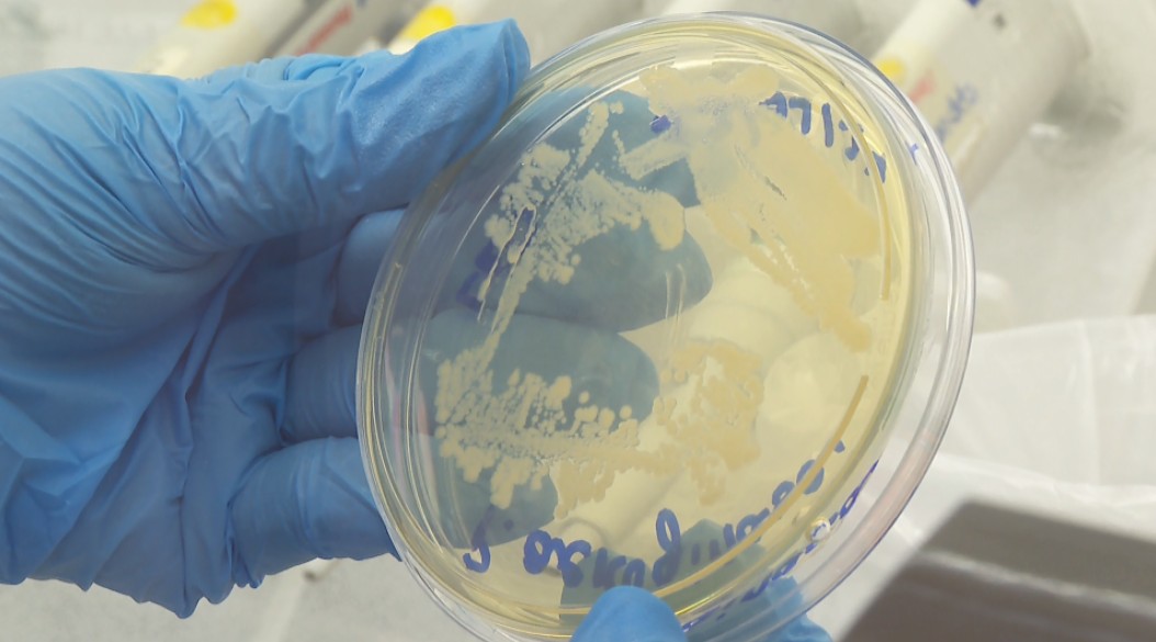Aplicação de luz pode ajudar no combate a bactérias super-resistentes, diz pesquisa da USP 