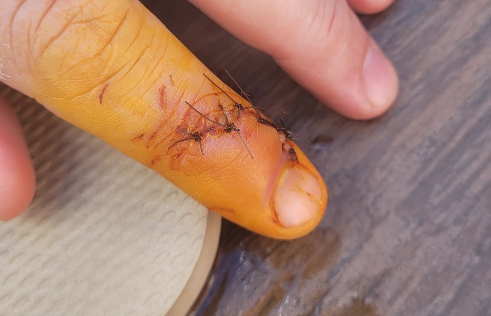 Banhista foi mordido por peixe em atrativo de Bonito em 2023. — Foto: Arquivo pessoal