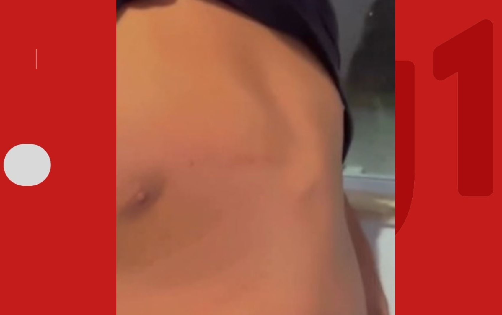 Estudante é agredido por colegas dentro de escola na Bahia; vítima recebeu mais de 20 pontos na boca