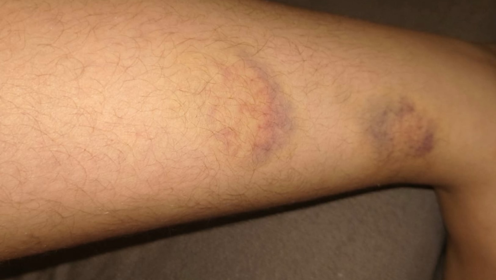 De conteúdos violentos a falta de escuta: especialista aponta causas para alta de agressões em escolas estaduais em Campinas