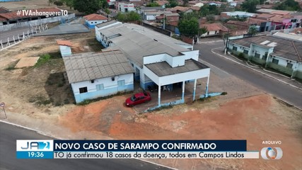 Mais um caso de sarampo é confirmado em Campos Lindos