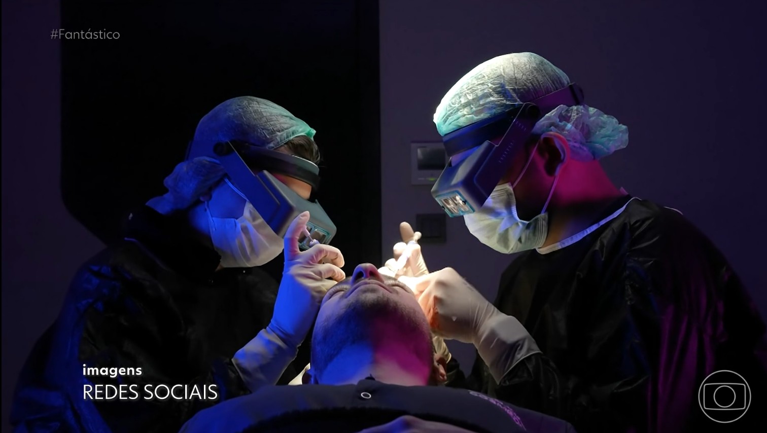 Turquia vira capital mundial do transplante capilar e atrai pacientes de todo o mundo