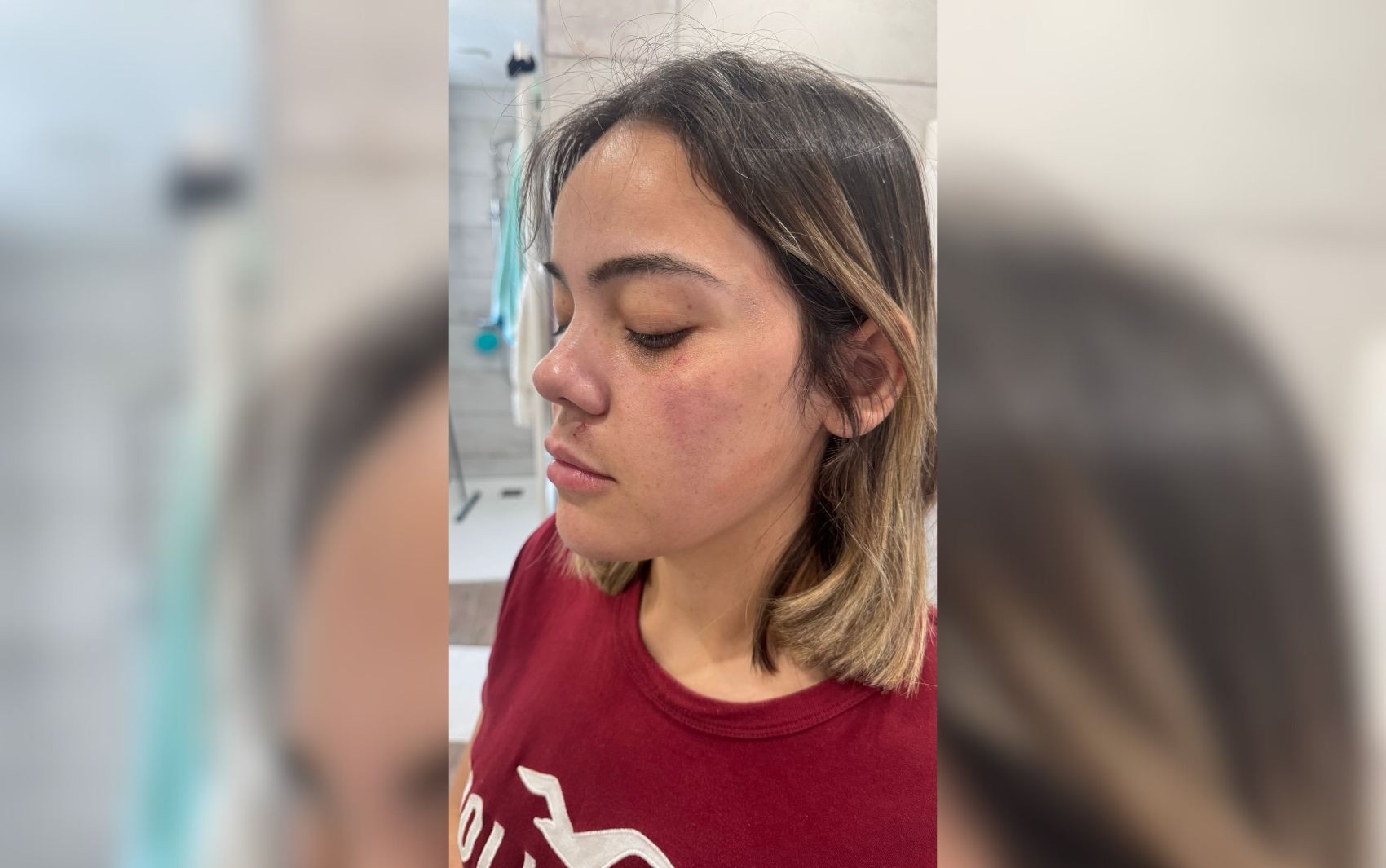 Brasileira que sofreu tentativa de estupro em metrô foi mordida no lábio e está traumatizada, diz irmão