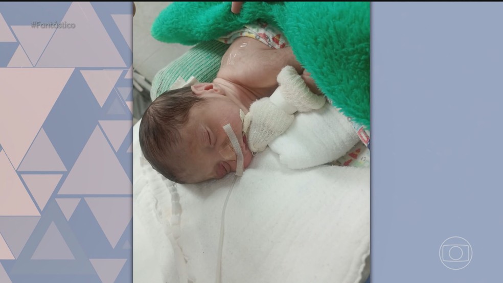 Médicos tentam explicar caso de bebê dado como morto que voltou a respirar — Foto: Reprodução/TV Globo