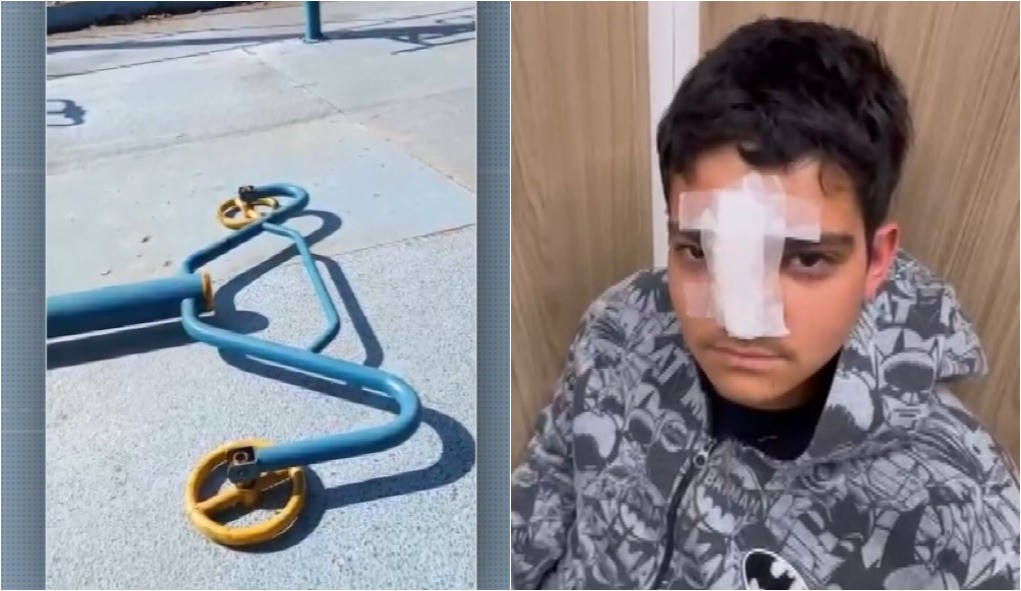Adolescente fratura ossos do rosto após ser atingido por aparelho de academia ao ar livre em Campinas