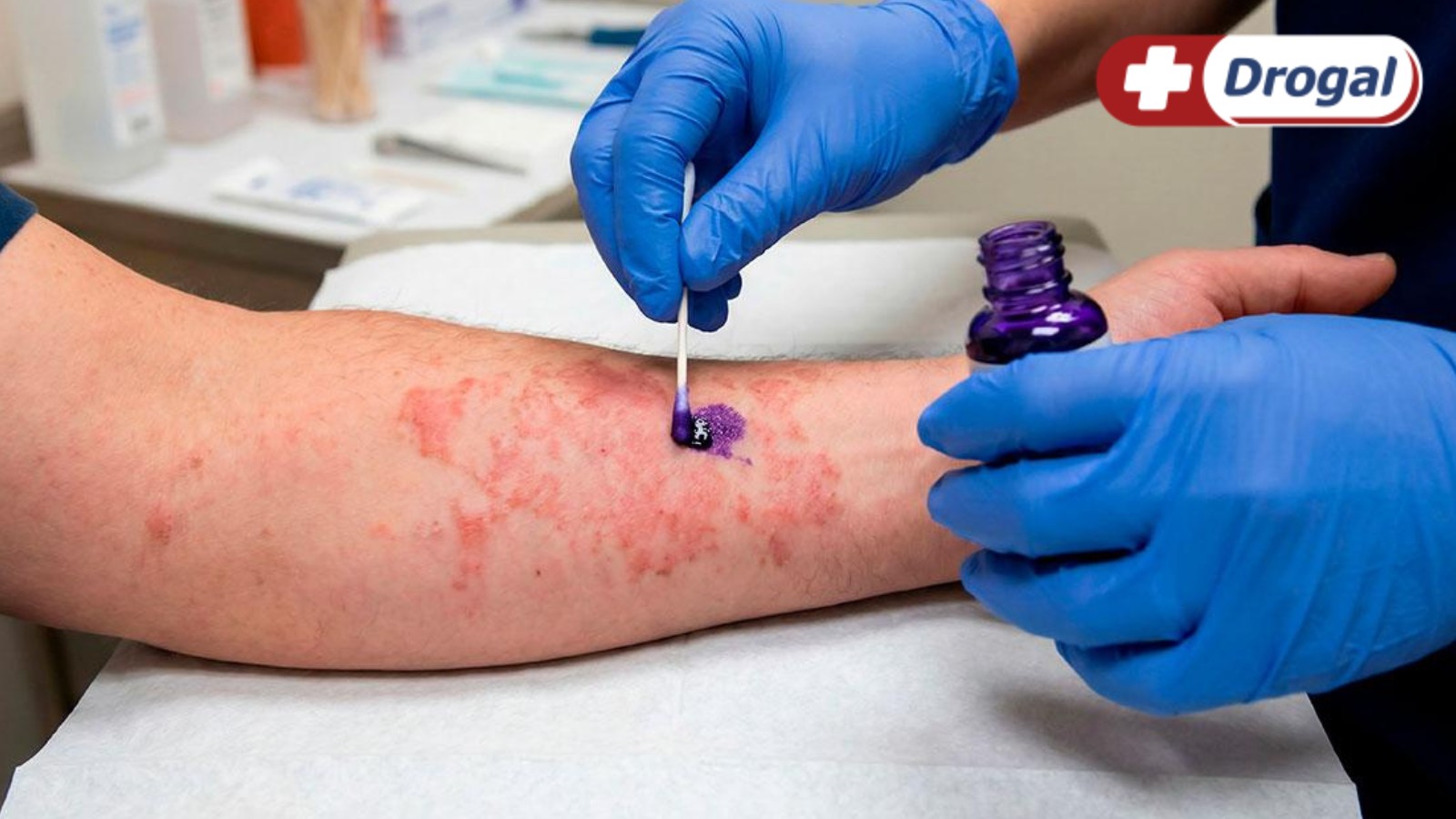 Para que serve a violeta genciana? Conheça todas as funcionalidades
