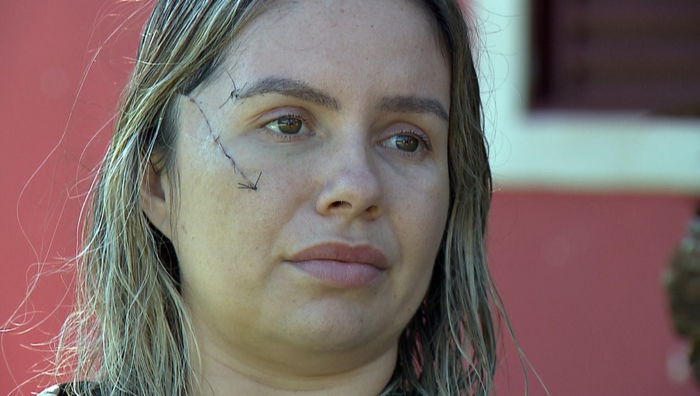 Influencer Daniele Gonçalves foi atacada a facadas pelo ex-companheiro em  Londrina