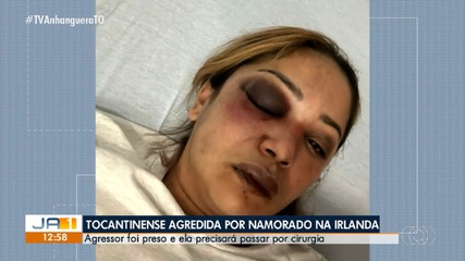 Tocantinense agredida por namorado na Irlanda deve passar por cirurgia, diz sobrinha