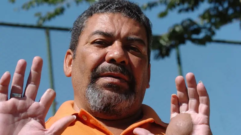 'Meu irmão comprou sem saber a cápsula de césio-137 que desencadeou maior acidente radioativo do Brasil'