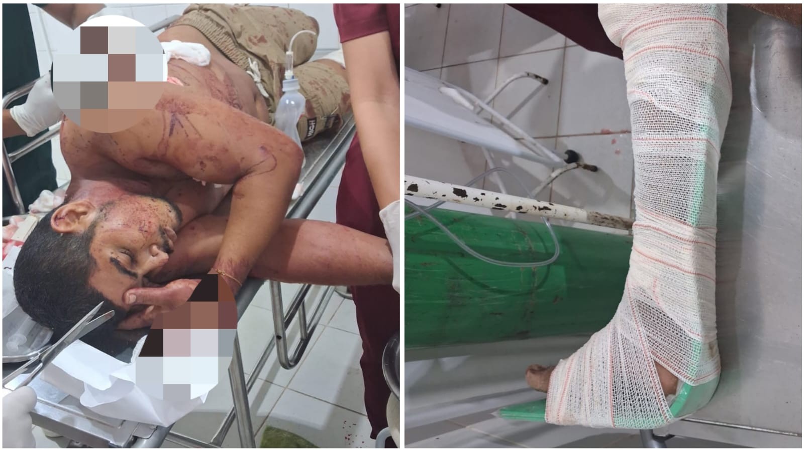 Jovem sofre tentativa de homicídio no feriado de Natal em Óbidos