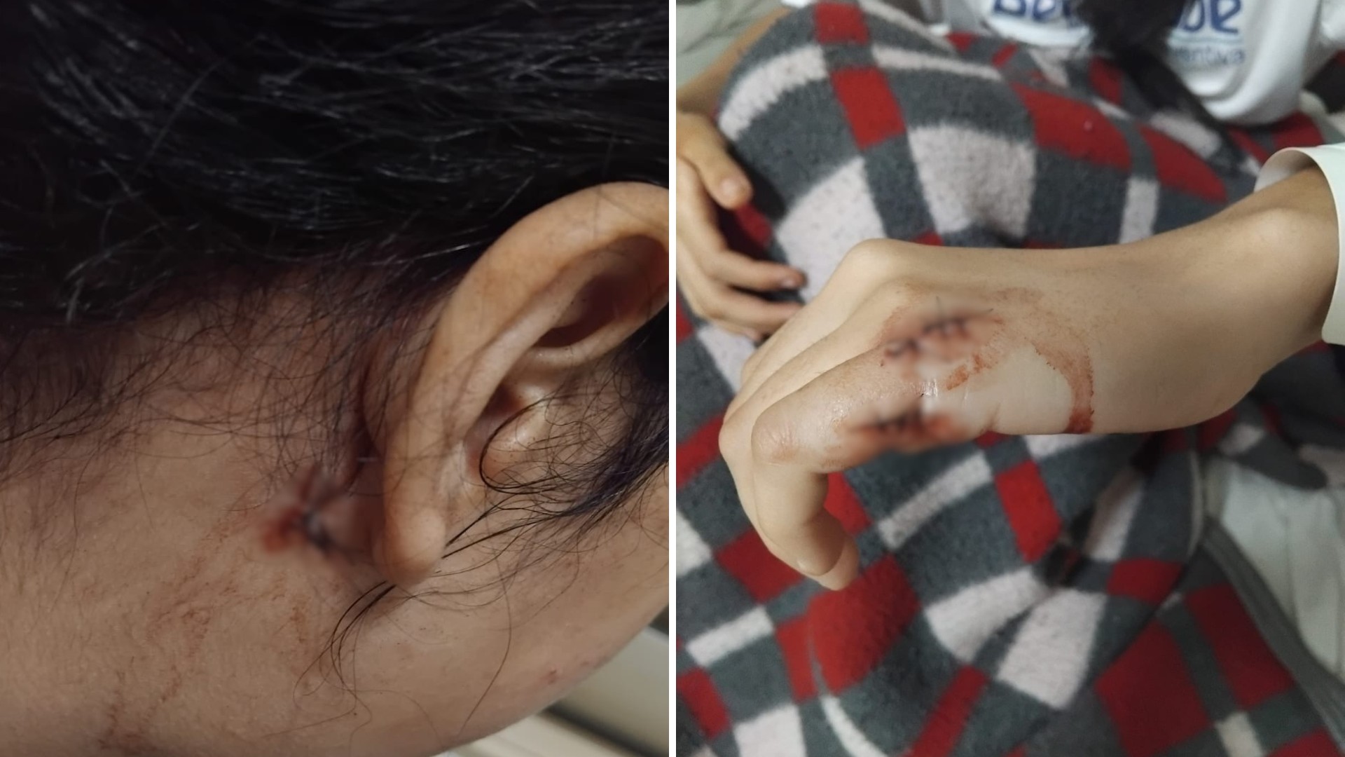 'Ela chora bastante', diz pai de adolescente esfaqueada na cabeça por estudante dentro de sala de aula em escola no interior de SP